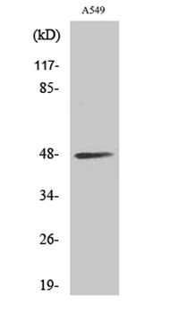 sMtCK rabbit pAb Antibody