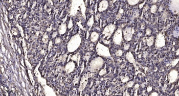 sMtCK rabbit pAb Antibody