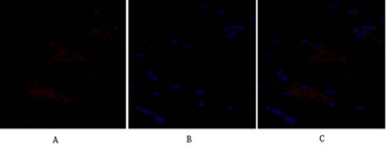 SNAI 1 rabbit pAb Antibody