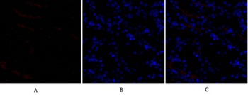 SNAI 1 rabbit pAb Antibody