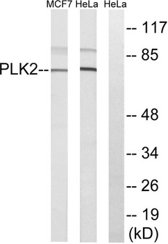Snk rabbit pAb Antibody