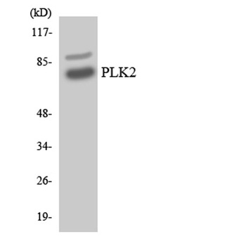 Snk rabbit pAb Antibody