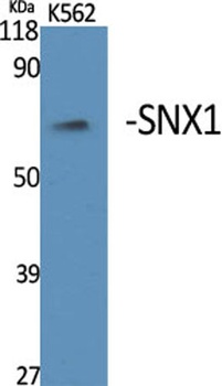 SNX1 rabbit pAb Antibody