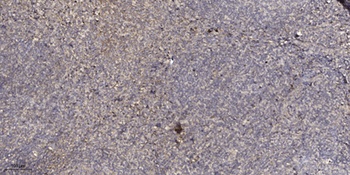 SP-B rabbit pAb Antibody