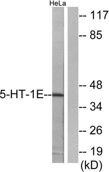 SR-1E rabbit pAb Antibody