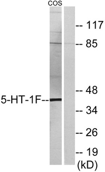 SR-1F rabbit pAb Antibody