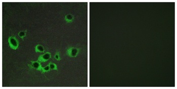 SR-2B rabbit pAb Antibody