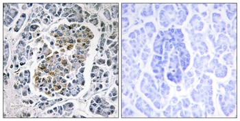 SSBP1 rabbit pAb Antibody