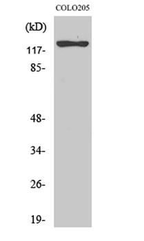 ST5 rabbit pAb Antibody