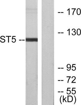 ST5 rabbit pAb Antibody