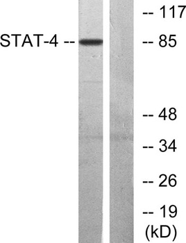 Stat4 rabbit pAb Antibody