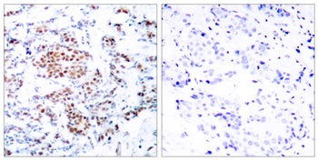 Stat5 rabbit pAb Antibody
