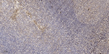 Stathmin-3 rabbit pAb Antibody