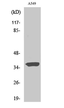 STEAP1 rabbit pAb Antibody