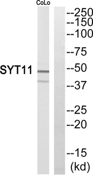 Synaptotagmin XI rabbit pAb Antibody