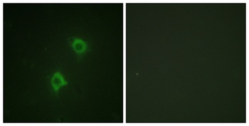 Syntaxin 1 rabbit pAb Antibody