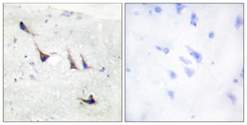 Syntaxin 1 rabbit pAb Antibody