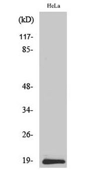 Synuclein-β rabbit pAb Antibody