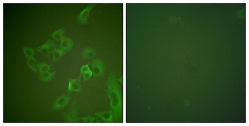 Synuclein-β rabbit pAb Antibody