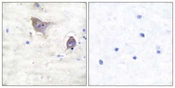 Synuclein-β rabbit pAb Antibody