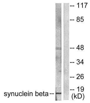 Synuclein-β rabbit pAb Antibody