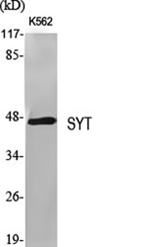 SYT rabbit pAb Antibody