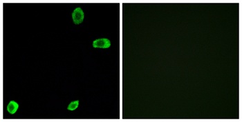 T2R39 rabbit pAb Antibody