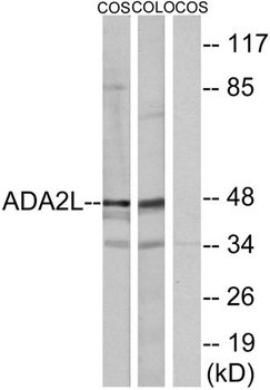 TADA2L rabbit pAb Antibody