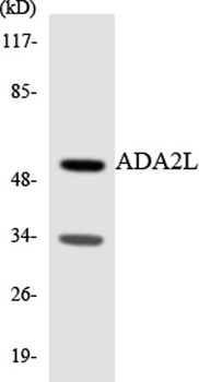 TADA2L rabbit pAb Antibody
