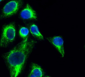 Tau rabbit pAb Antibody
