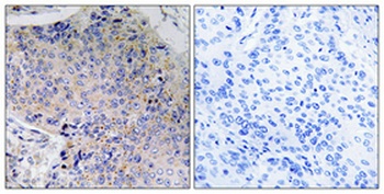 Tau rabbit pAb Antibody
