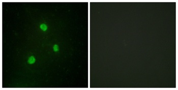 TBX1 rabbit pAb Antibody