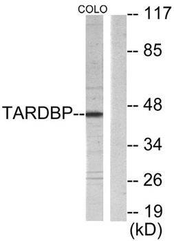 TBX1 rabbit pAb Antibody