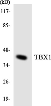 TBX1 rabbit pAb Antibody