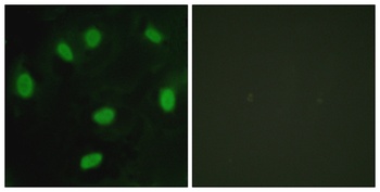 TBX15/18 rabbit pAb Antibody