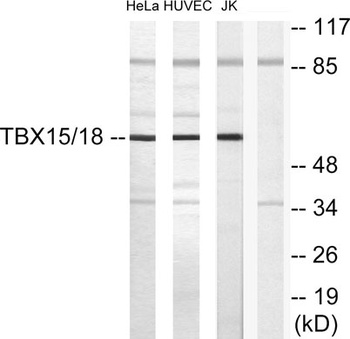 TBX15/18 rabbit pAb Antibody