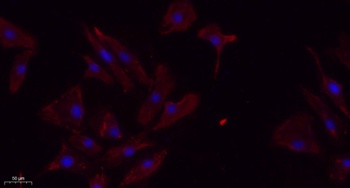 TGFβ RII rabbit pAb