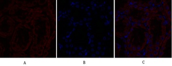 TGFβ RII rabbit pAb