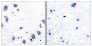Tyrosine Hydroxylase rabbit pAb Antibody