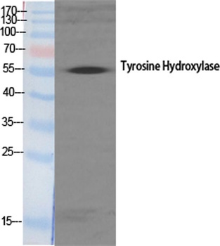 Tyrosine Hydroxylase rabbit pAb Antibody