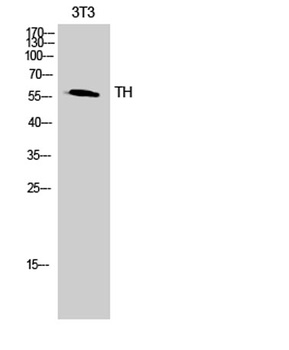 Tyrosine Hydroxylase rabbit pAb Antibody