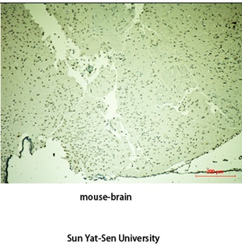 Tyrosine Hydroxylase rabbit pAb Antibody