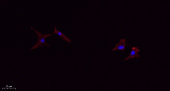TIMP-1 rabbit pAb Antibody