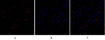 TIMP-1 rabbit pAb Antibody