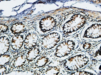 TIMP-2 rabbit pAb Antibody