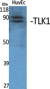 TLK1 rabbit pAb Antibody