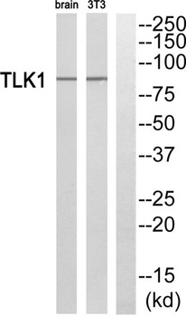TLK1 rabbit pAb Antibody