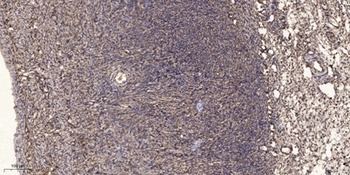 TLK1 rabbit pAb Antibody