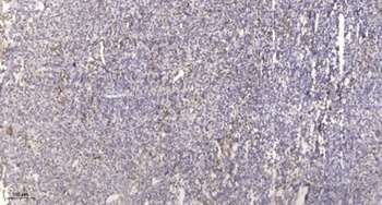 TNF-IP 1 rabbit pAb Antibody