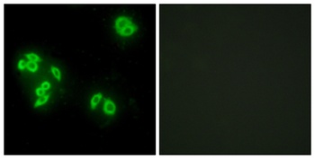 TNF-IP 8 rabbit pAb Antibody